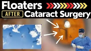 Cataracts & Floaters