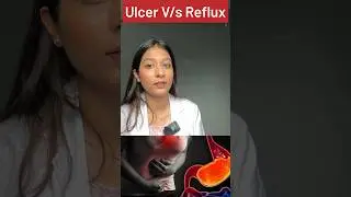 Ulcer V/s Reflux disease in 1 min #medicine #neet #neetpg #doctor #medicaldoctor