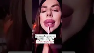 THE BIGGEST LIPS IN THE WORLD