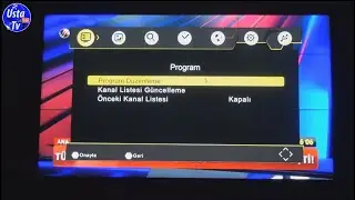 Sunny, Axen kanal arama ve kanal taşıma