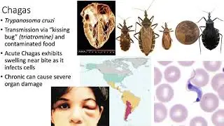 Parasite and Fungal Diseases