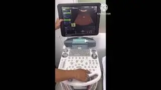 How to manipulate GE Voluson P8 ultrasound