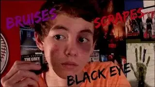 Black Eye, Bruises, Scrapes: Special FX Makeup