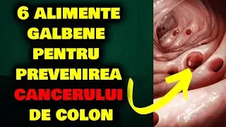 6 ALIMENTE GALBENE PENTRU A PREVENI CANCERUL DE COLON  ȘI POLIPII!