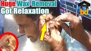 ►[Grandpa=Grandpa] Most Impressive Earwax Removal that's Feeling was Awesome-Special Ear Cleaning