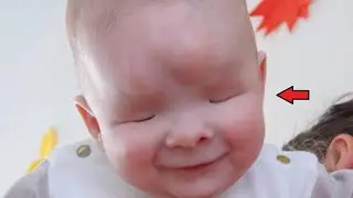 The mother abandoned the child who was born without eyes. History to tears!