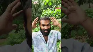 கிலித்து 👦|HAIR TRANSPLANT | Fun Da |Malayalam Comedy |Shorts|