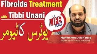 Fibroids Treatment with Tibbi Unani in Urdu/Hindi | Life Skills TV