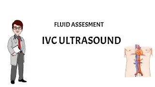 IVC Ultrasound ! Bedside Assessment of Fluid Status #ivc #pocus #bedsideultrasound #icu #doctorlife