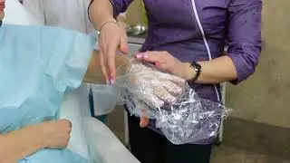 Омоложение рук Fractora