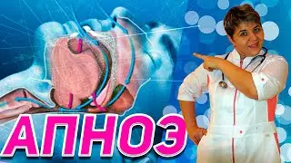 💊 Sleep apnea - causes, symptoms, pathogenesis, diagnosis, treatment. Questions for the doctor