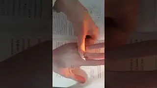 Су джок семянотерапия🌿при недержании мочи. 