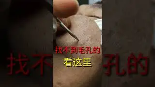Best Satifying videos for Relaxation with Rat Tana Acne Spa =Short