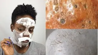 DIY Egg Blackhead & Whithead Remover Peel Off Mask