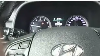 HYUNDAI KIA LỖI HỆ THỐNG LẠNH