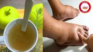 MANZANA CON ROMERO, conoce todos sus beneficios.