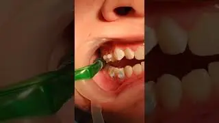 #стоматологалматы #брекетыалматы #ортодонталматы