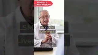 Fibroscan Of Liver - What Do My Scores Mean in 30 Seconds? | Fatty Liver | Fibroscan Score