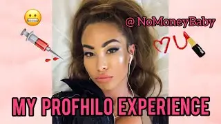 PROFHILO  -  game changer or just another facial? My experience with the treatment.