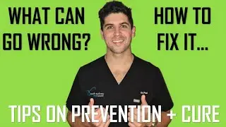 Wisdom Tooth Removal (Extraction) - Potential Problems + How to Fix Them | Dr Paul Shalhoub