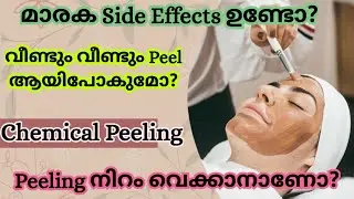 Chemical Peel കൊണ്ടുള്ള ഗുണങ്ങൾ ദോഷങ്ങൾ