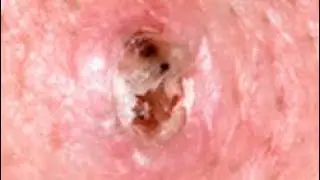 America's Most Satisfying Pops!  Cleansing Dermatology