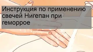 Инструкция по применению свечей Нигепан при геморрое