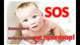 Отзыв  о продукции FOHOW Германия - нейродермит, аллергия