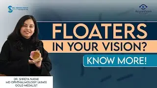 Floaters in your vision? - Know More | Dr. Shreya Nayak
