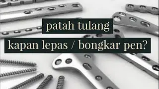 patah tulang pasang pen kapan bisa di lepas / bongkar?