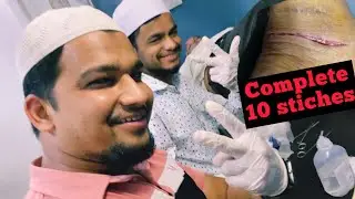 10 sutures deep wound||Interupted suture with the basic method