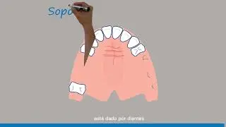 Biomecánica  de la prótesis parcial removible, la forma más fácil de entenderla