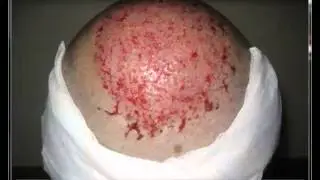 F6C2D775 0254 461D AA67 ADF55CE3C51C