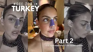 I Flew to Turkey for a Nose Job👃🇹🇷  PART 2. Honest Recovery vlog | Dr. Yusuf Orhan | Clinichub