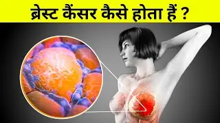 ब्रेस्ट कैंसर कैसे होता हैं ? Breast Cancer Etiology and pathophysiology in short