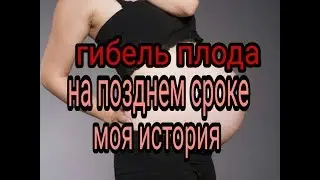 Антенатальная гибель плода/Моя СТРАШНАЯ история беременности/5 дней кошмара/Как я это пережила/