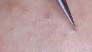 Best Satifying videos for Relaxation with Rat Tana Acne Spa =Short