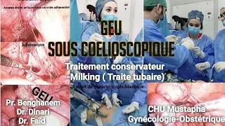 Traitement conservateur d'une GEU sous coelioscopie- Milking-