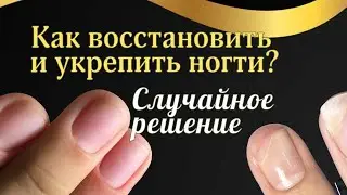 КАК ВЕРНУТЬ НОГТИ ЗА 2,5 МЕСЯЦА И УКРЕПИТЬ ИХ? И немного про контакт с телом...