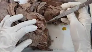 Larynx