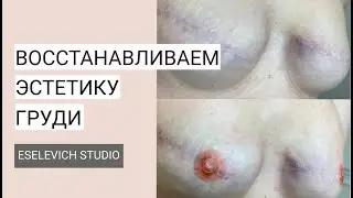 Коррекция ареол с помощью перманента после Мастэктомии.  Как вернуть уверенность женщине?