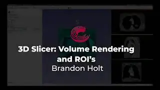 3D Slicer: Volume Rendering and ROI's