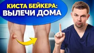Главные ПРАВИЛА лечения боли под коленом. Избавься от кисты Бейкера НАВСЕГДА!
