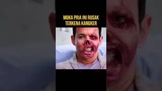 THIS MAN NEEDS SUPPORT BEFORE HAS AN OPERATION 