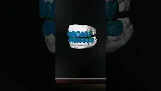 Diamond Grillz Model 