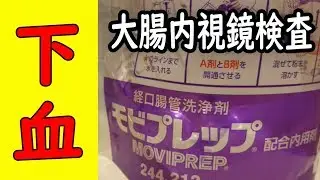 お尻から突然の出血。(下血) 先ず大腸がんを疑う :大腸内視鏡検査
