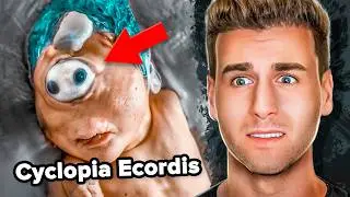7 UNBELIEVABLE Cases Of RARE Genetic Mutations (0.001% Chance)