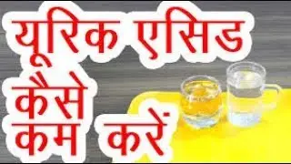 HOW TO CONTROL URIC ACID? यूरिक एसिड  कैसे कम करें? by Dr. Manoj Das