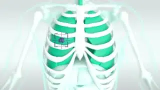 What is External Beam Radiation Therapy? | SERO
