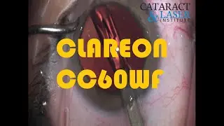 NEW: ALCON Clareon CC60WF the NEW SA60WF